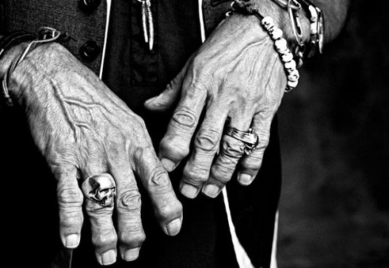 Keith Richards arthrose des doigts